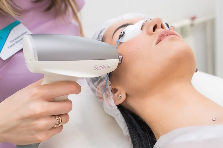 kryerja e një procedure për përtëritje të lëkurës me lazer